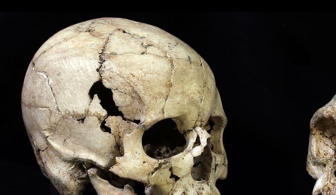 El tamaño del cerebro es sorprendente. El hombre de Flores tenía la estatura de un niño de tres años, pero su cerebro era tres veces más pequeño.