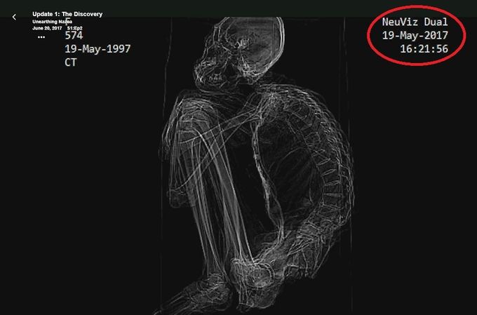 Radiografía de María 